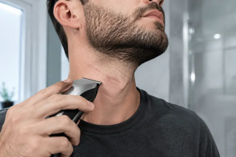 چرا ماشین اصلاح روی گردن بیشتر پوست را میزند؟